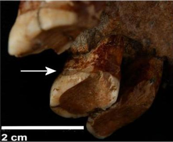 neanderthal-teeth-toothpicks