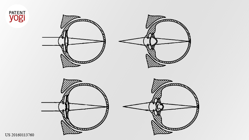 PatentYogi_Google patents cyborg eyeball